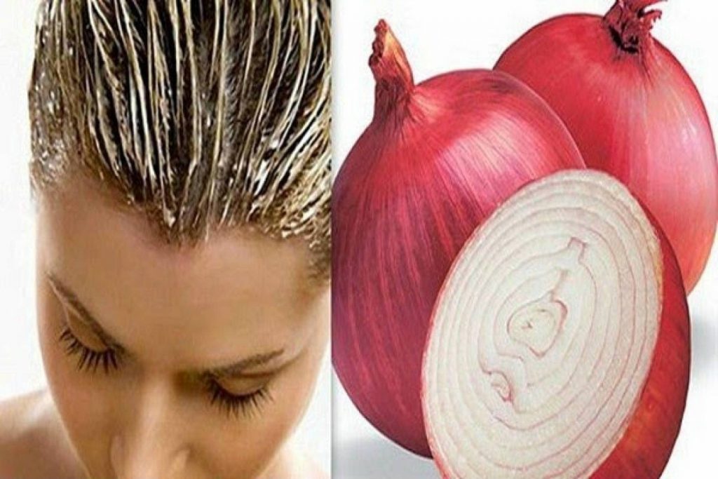 7 Surprising And Natural Onion Remedies You Can Use At Home