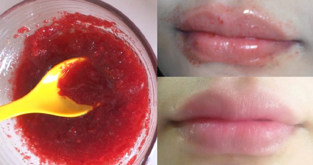 How To Get Rid Of Dry Dark Lips Naturally At Home